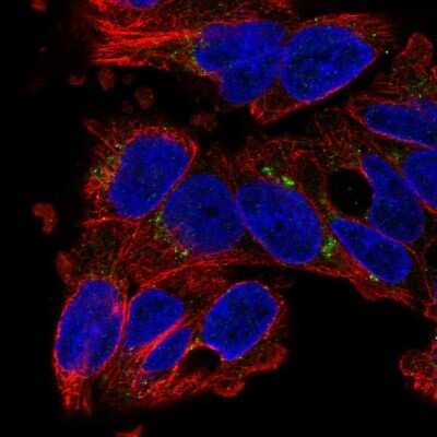 Immunocytochemistry/Immunofluorescence: SLC29A3 Antibody [NBP2-58806] - Staining of human cell line Hep G2 shows localization to the Golgi apparatus & vesicles.