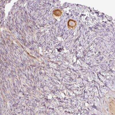 Immunohistochemistry-Paraffin: SLC29A3 Antibody [NBP2-31589] - Staining of human ovary shows strong cytoplasmic positivity in follicle cells.