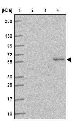 Western Blot: SLC29A3 Antibody [NBP2-31589] - Lane 1: Marker  [kDa] 250, 130, 95, 72, 55, 36, 28, 17, 10.  Lane 2: Human cell line RT-4.  Lane 3: Human cell line U-251MG sp.  Lane 4: Human plasma (IgG/HSA depleted)