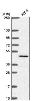 Western Blot: SLC29A3 Antibody [NBP2-58230] - Analysis in human cell line RT-4.