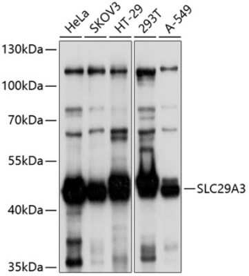 Western Blot: SLC29A3 Antibody [NBP2-93466] - Analysis of extracts of various cell lines, using SLC29A3 at 1:1000 dilution. Secondary antibody: HRP Goat Anti-Rabbit IgG (H+L) at 1:10000 dilution. Lysates/proteins: 25ug per lane. Blocking buffer: 3% nonfat dry milk in TBST. Detection: ECL Basic Kit . Exposure time: 5s.