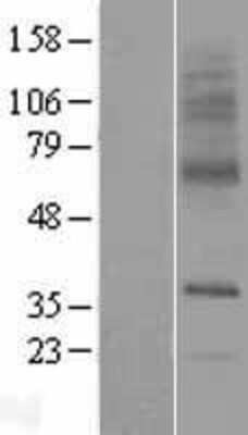 Western Blot: SLC29A3 Overexpression Lysate (Adult Normal) [NBP2-06813] Left-Empty vector transfected control cell lysate (HEK293 cell lysate); Right -Over-expression Lysate for SLC29A3.