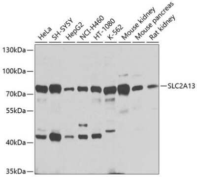 Western Blot: SLC2A13 Antibody [NBP2-94351] - Analysis of extracts of various cell lines, using SLC2A13 at 1:1000 dilution. Secondary antibody: HRP Goat Anti-Rabbit IgG (H+L) at 1:10000 dilution. Lysates/proteins: 25ug per lane. Blocking buffer: 3% nonfat dry milk in TBST. Detection: ECL Basic Kit . Exposure time: 1s.