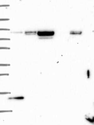 Western Blot: SLC2A13 Antibody [NBP3-17114] - Lane 1: Marker [kDa] 250, 130, 95, 72, 55, 36, 28, 17, 10;   Lane 2: RT4;   Lane 3: U-251 MG;   Lane 4: Human Plasma;   Lane 5: Liver;   Lane 6: Tonsil