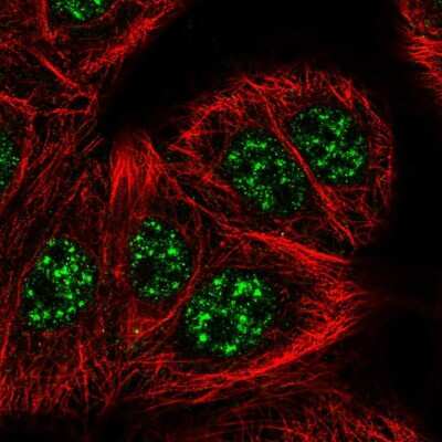 Immunocytochemistry/Immunofluorescence: SLC2A4RG Antibody [NBP2-57221] - Staining of human cell line MCF7 shows localization to nuclear speckles.