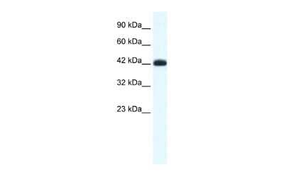 Western Blot: SLC2A4RG Antibody [NBP2-88297] - WB Suggested Anti-SLC2A4RG Antibody Titration: 0.2-1 ug/ml. ELISA Titer: 1:62500. Positive Control: Jurkat cell lysate