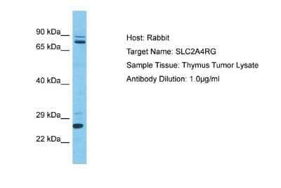 Western Blot: SLC2A4RG Antibody [NBP2-88299] - Host: Rabbit. Target Name: SLC2A4RG. Sample Type: Thymus Tumor lysates. Antibody Dilution: 1.0ug/ml