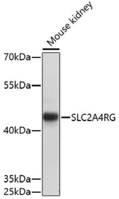 Western Blot: SLC2A4RG Antibody [NBP2-93156] - Analysis of extracts of mouse kidney, using SLC2A4RG at 1:1000 dilution.Secondary antibody: HRP Goat Anti-Rabbit IgG (H+L) at 1:10000 dilution.Lysates/proteins: 25ug per lane.Blocking buffer: 3% nonfat dry milk in TBST.Detection: ECL Basic Kit .Exposure time: 10s.