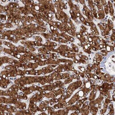 Immunohistochemistry-Paraffin: SLC2A7 Antibody [NBP1-81821] - Staining of human liver shows strong cytoplasmic positivity in granular pattern in hepatocytes.