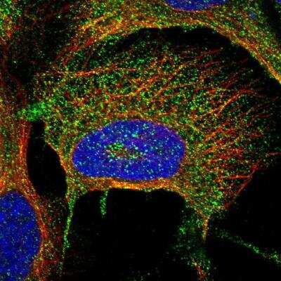 Immunocytochemistry/Immunofluorescence: SLC30A2 Antibody [NBP1-80579] - Staining of human cell line U-2 OS shows localization to vesicles. Antibody staining is shown in green.