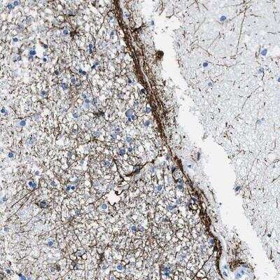 Immunohistochemistry SLC30A4 Antibody