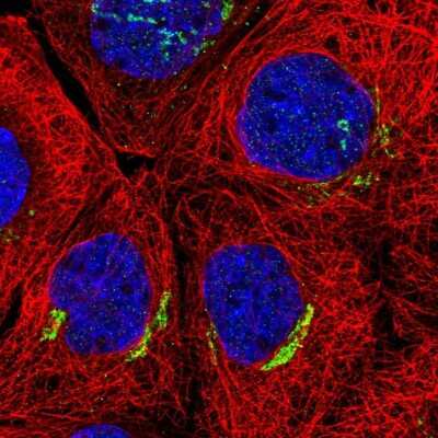 Immunocytochemistry/Immunofluorescence: SLC30A6 Antibody [NBP2-55067] - Staining of human cell line A-431 shows localization to the Golgi apparatus.