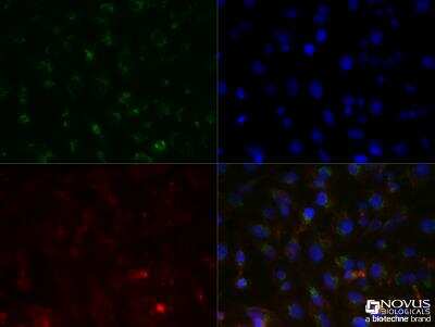Immunocytochemistry/Immunofluorescence: SLC31A1/CTR1 Antibody (3C7.1B7) [NBP2-36574] - HepG2 cells were fixed for 10 minutes using 10% formalin and then permeabilized for 5 minutes using 1X TBS + 0.5% Triton X-100.  The cells were incubated with anti SLC31A1/CTR1 (3C7.1B7) at 1:50 overnight at 4C and detected with an anti-mouse Dylight 488 (Green) at 1:500.  Actin was detected with Phalloidin 568 (Red) at 1:200.  Nuclei were counterstained with DAPI (Blue). Cells were imaged using a 40X objective.
