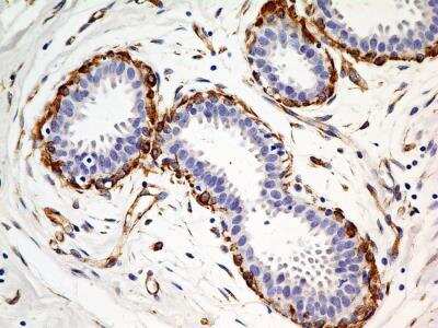 Immunohistochemistry-Paraffin: SLC31A1/CTR1 Antibody (3C7.1B7) [NBP2-36574] - Analysis of a FFPE tissue section of normal breast tissue from a human breast cancer patient (NBP2-30234) using purified CTR1/SLC31A1 antibody clone 3C7.1B7 at 5 ug/mL. The antibody generated strong cytoplasmic staining in the myo-epithelial cells in the tested section.