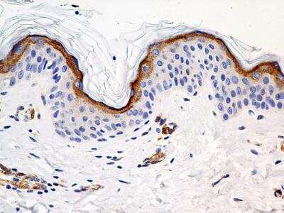 Immunohistochemistry-Paraffin: SLC31A1/CTR1 Antibody (3C7.1B7) [NBP2-36574] - Analysis of a FFPE tissue section of normal skin from a human breast cancer patient (NBP2-30234) using purified CTR1/SLC31A1 antibody clone 3C7.1B7 at 5 ug/mL concentration. The antibody developed a strong cytoplasmic staining in the outer layer of stratum spinosum and the cells of stratum granulosum/ granular layer of skin epidermis.