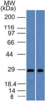 Western Blot: SLC31A1/CTR1 Antibody (3C7.1B7) [NBP2-36574] - Analysis of SLC31A1/CTR1 in MCF7 and HeLa at 2 ug/mL