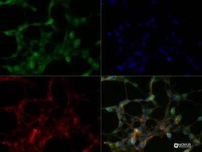 Immunocytochemistry/Immunofluorescence: SLC34A1 Antibody (10B1.3E9) - Azide and BSA Free [NBP2-80953] - Hek293 cells were fixed for 10 minutes using 10% formalin and then permeabilized using 1X TBS + 0.5% Triton-X100. The cells were incubated with hSLC34A1 (10B1.3E9) at a 1:50 dilution overnight at 4 degrees Celsius and detected with Dylight 488 (Green). Actin was detected with Phalloidin 568 (Red). Nuclei were detected with DAPI (Blue). Cells were imaged using a 40X objective. Image from the standard format of this antibody.