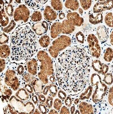 Immunohistochemistry: SLC34A1 Antibody (10B1.3E9) - Azide and BSA Free [NBP2-80953] - IHC analysis of a formalin-fixed and paraffin-embedded tissue section of human normal kidney using SLC34A1 antibody (clone 10B1.3E9) at 1:75 dilution. The epithelial cells of various renal ducts and tubules depicted very nice membrane-cytoplasmic SLC34A1