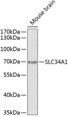 Western Blot: SLC34A1 Antibody [NBP2-94576] - Analysis of extracts of mouse brain, using SLC34A1 at 1:1000 dilution.Secondary antibody: HRP Goat Anti-Rabbit IgG (H+L) at 1:10000 dilution.Lysates/proteins: 25ug per lane.Blocking buffer: 3% nonfat dry milk in TBST.Detection: ECL Basic Kit .Exposure tim