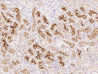 Immunohistochemistry-Paraffin: SLC34A3 Antibody [NBP3-06366] - Immunochemical staining of human SLC34A3 in human kidney with rabbit polyclonal antibody at 1:500 dilution, formalin-fixed paraffin embedded sections.