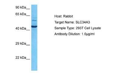 Western Blot: SLC34A3 Antibody [NBP1-79976] - Host: Rabbit. Target Name: SLC34A3. Sample Tissue: Human 293T Whole Cell. Antibody Dilution: 1ug/ml