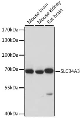 Western Blot: SLC34A3 Antibody [NBP2-93939] - Analysis of extracts of various cell lines, using SLC34A3 at 1:1000 dilution. Secondary antibody: HRP Goat Anti-Rabbit IgG (H+L) at 1:10000 dilution. Lysates/proteins: 25ug per lane. Blocking buffer: 3% nonfat dry milk in TBST. Detection: ECL Basic Kit . Exposure time: 10s.