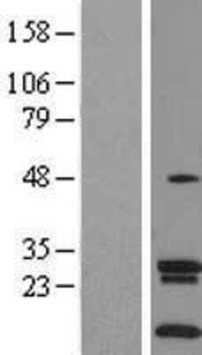Western Blot SLC35A4 Overexpression Lysate