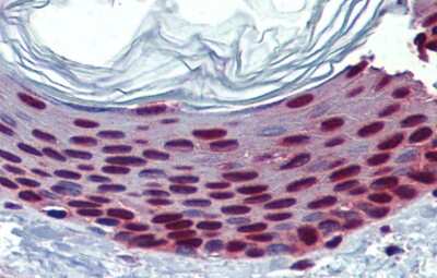 Immunohistochemistry-Paraffin: SLC35A5 Antibody [NBP1-62284] - Human Skin Tissue, 5.0ug/ml.