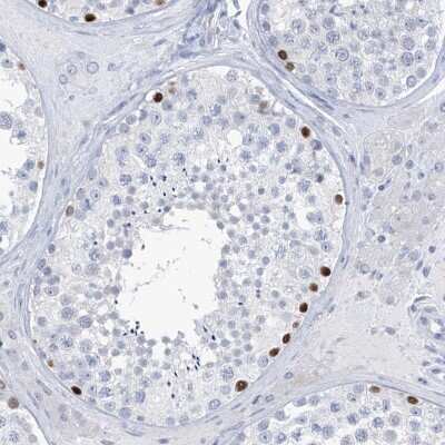 Immunohistochemistry-Paraffin: SLC35A5 Antibody [NBP1-83636] - Staining of human testis shows strong nuclear positivity in cells in seminiferous ducts.