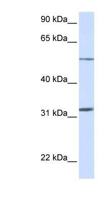 Western Blot: SLC35A5 Antibody [NBP1-62284] - Titration: 0.2-1 ug/ml, Positive Control: Human Muscle.