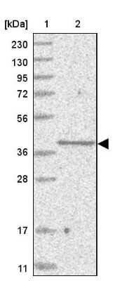 Western Blot: SLC35A5 Antibody [NBP1-83636] - Lane 1: Marker  [kDa] 230, 130, 95, 72, 56, 36, 28, 17, 11.  Lane 2: Human cell line RT-534