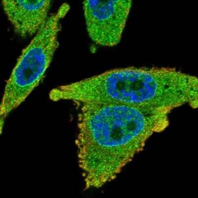 Immunocytochemistry/Immunofluorescence: SLC35B1 Antibody [NBP2-58270] - Staining of human cell line PC-3 shows localization to nucleoplasm & endoplasmic reticulum.