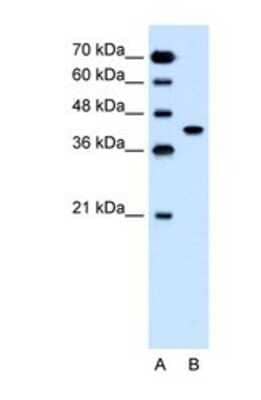 Western Blot: SLC35B1 Antibody [NBP1-69299] - This Anti-SLC35B1 antibody was used in Western Blot of Jurkat tissue lysate at a concentration of 1.25ug/ml.