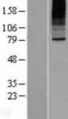 Western Blot: SLC35B2 Overexpression Lysate (Adult Normal) [NBP2-04970] Left-Empty vector transfected control cell lysate (HEK293 cell lysate); Right -Over-expression Lysate for SLC35B2.