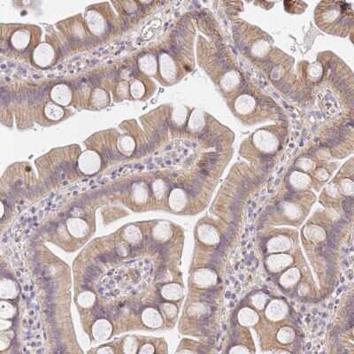 Immunohistochemistry SLC35B3 Antibody