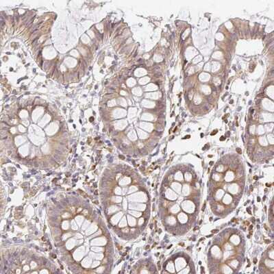 Immunohistochemistry SLC35B3 Antibody