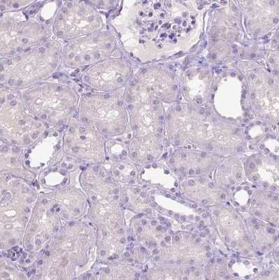 Immunohistochemistry-Paraffin: SLC35C1 Antibody [NBP2-49410] - Staining of human kidney shows no positivity in cells in tubules as expected.