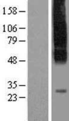 Western Blot: SLC35C1 Overexpression Lysate (Adult Normal) [NBP2-06810] Left-Empty vector transfected control cell lysate (HEK293 cell lysate); Right -Over-expression Lysate for SLC35C1.