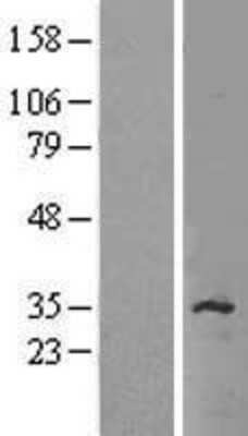 Western Blot: SLC35C2 Overexpression Lysate (Adult Normal) [NBP2-05142] Left-Empty vector transfected control cell lysate (HEK293 cell lysate); Right -Over-expression Lysate for SLC35C2.