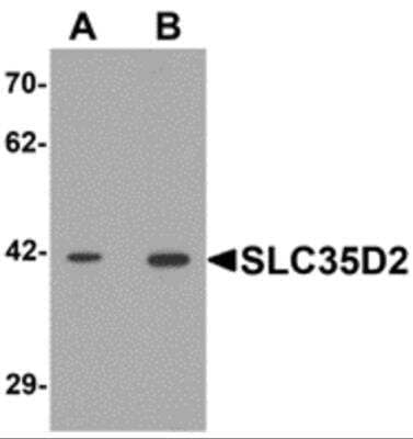 Western Blot SLC35D2 Antibody - BSA Free