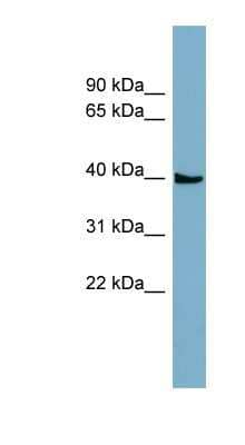 Western Blot: SLC35D3 Antibody [NBP1-59746] - Titration: 0.2-1 ug/ml, Positive Control: ACHN cell lysate.