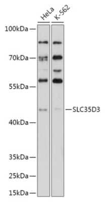 Western Blot: SLC35D3 Antibody [NBP2-94451] - Analysis of extracts of various cell lines, using SLC35D3 . Exposure time: 90s.