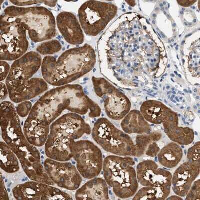 Immunohistochemistry-Paraffin: SLC35E1 Antibody [NBP1-94009] - Staining of human kidney shows cytoplasmic positivity in cells in tubules.