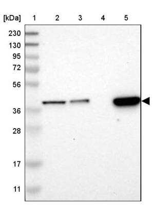 Western Blot: SLC35E1 Antibody [NBP1-94009] - Lane 1: Marker  [kDa] 230, 130, 95, 72, 56, 36, 28, 17, 11.  Lane 2: Human cell line RT-4.  Lane 3: Human cell line U-251MG sp.  Lane 4: Human plasma (IgG/HSA depleted).  Lane 5: Human liver tissue