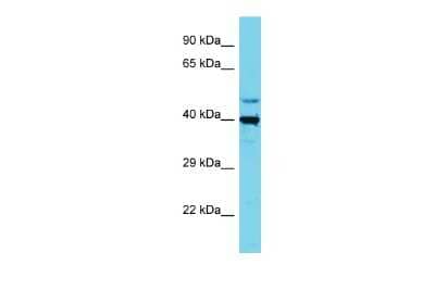 Western Blot: SLC35E1 Antibody [NBP2-85751] - Host: Rabbit. Target Name: SLC35E1. Sample Type: HepG2 Whole Cell lysates. Antibody Dilution: 1.0ug/ml