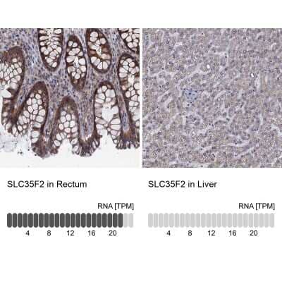 Immunohistochemistry-Paraffin: SLC35F2 Antibody [NBP3-17115] - Analysis in human rectum and liver tissues using Anti-SLC35F2 antibody. Corresponding SLC35F2 RNA-seq data are presented for the same tissues.