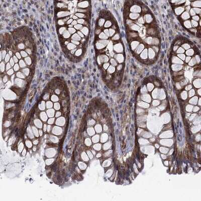 Immunohistochemistry-Paraffin: SLC35F2 Antibody [NBP3-17115] - Staining of human rectum shows high expression.