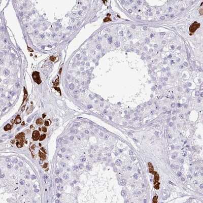 Immunohistochemistry-Paraffin: SLC35G2 Antibody [NBP2-14756] Staining of human testis shows strong cytoplasmic positivity in Leydig cells.