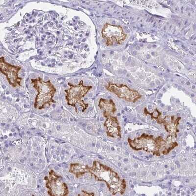 Immunohistochemistry: SLC36A2 Antibody [NBP2-49360] - Staining of human kidney shows luminal positivity in renal tubules.