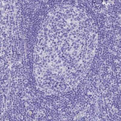 Immunohistochemistry-Paraffin: SLC36A2 Antibody [NBP1-92401] - Staining of human lymph node shows low expression as expected.